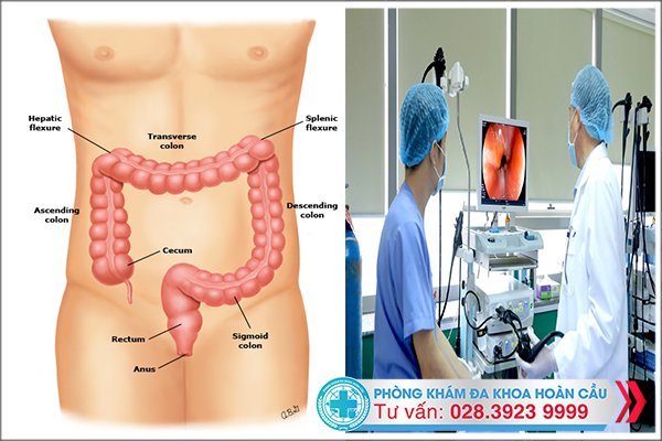 Cần chữa bệnh polyp đại tràng tại địa chỉ uy tín