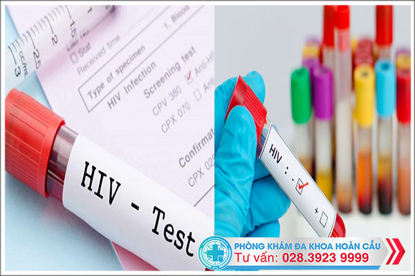 Phương pháp test nhanh HIV được nhiều bệnh nhân chọn lựa