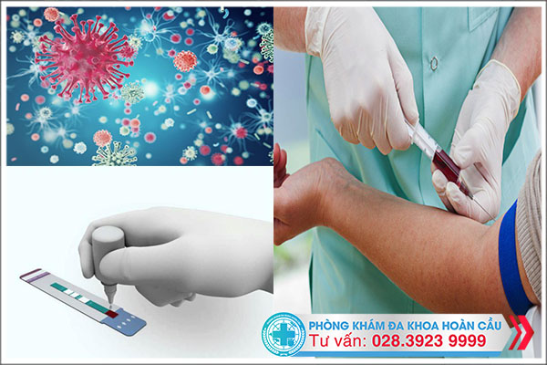 Xét nghiệm HIV combo giúp phát hiện sớm bệnh HIV