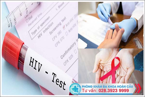 Cần sớm làm xét nghiệm HIV