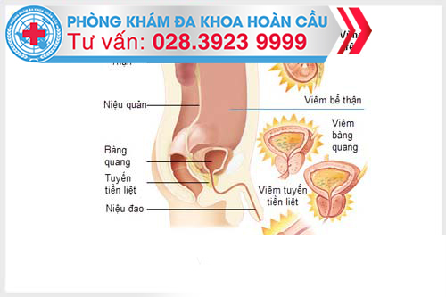 Bệnh đường tiết niệu